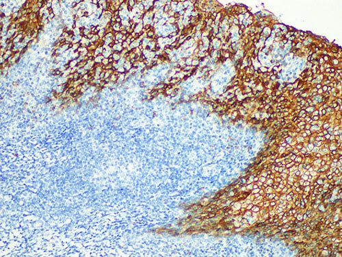 EMA Monoclonal Antibody Stored at -20°C