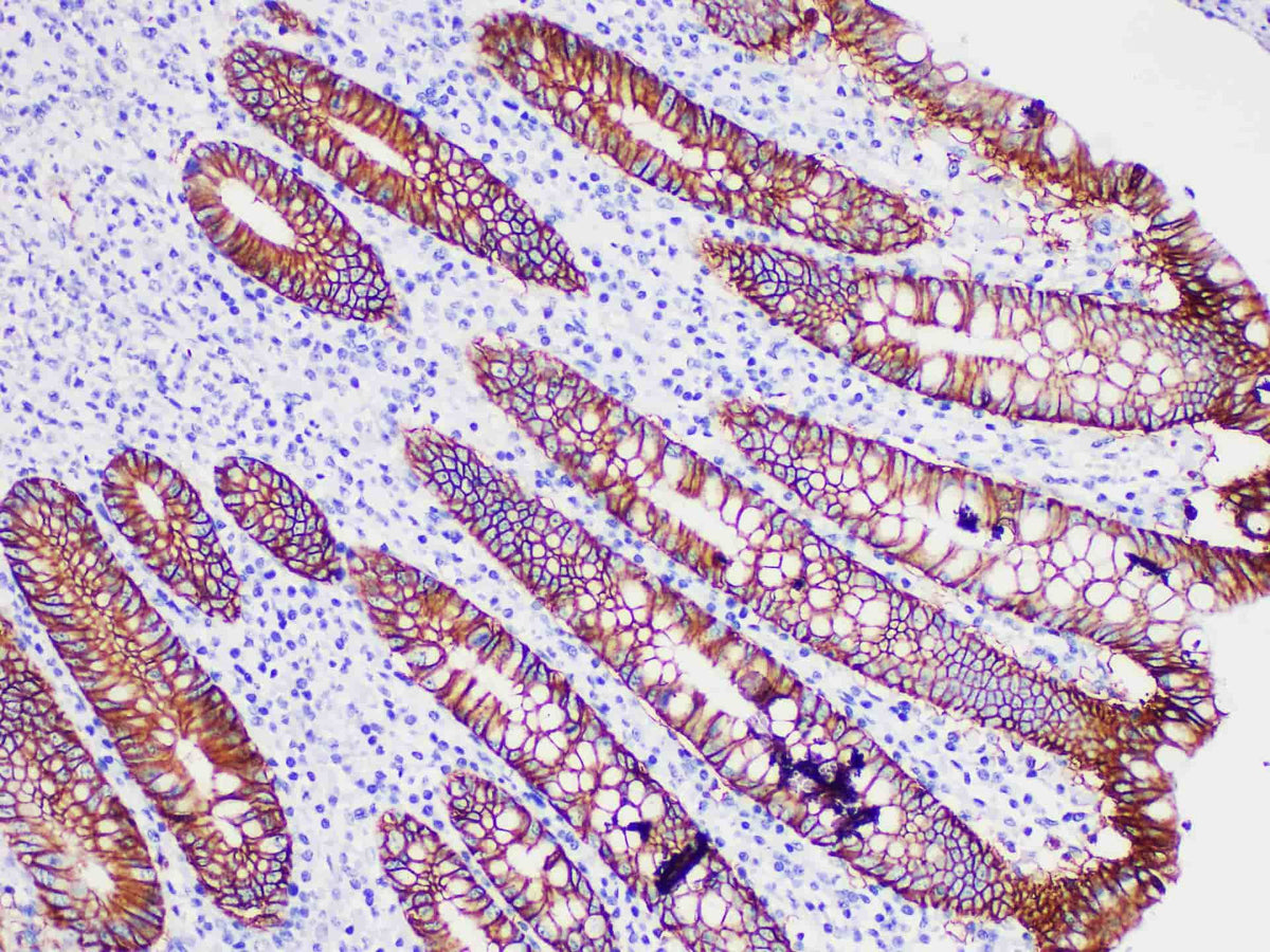 Ep-CAM (Ber-EP4) Monoclonal Antibody