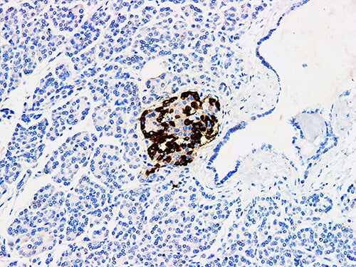 Glucagon Monoclonal Antibody Stored at -20°C