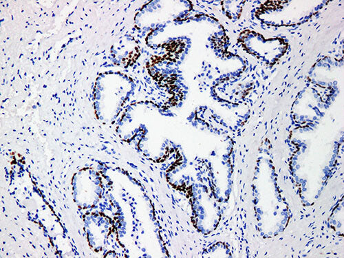 p63 Monoclonal Antibody stored at -20°C