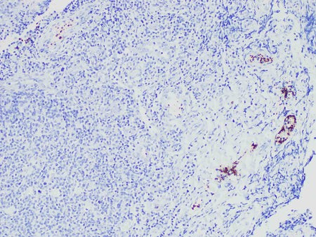 CD61 Monoclonal Antibody Stored at -20°C
