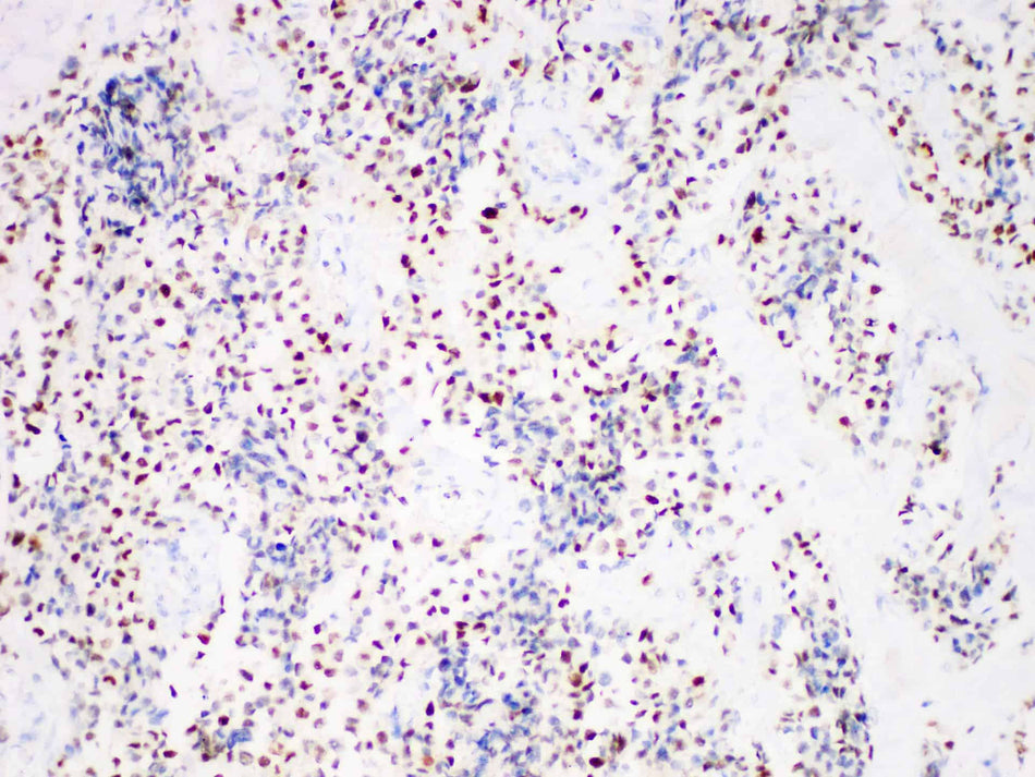 Myogenin Monoclonal Antibody Stored at -20°C