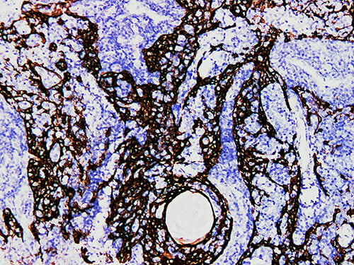 CK14 Monoclonal Antibody Stored at -20°C