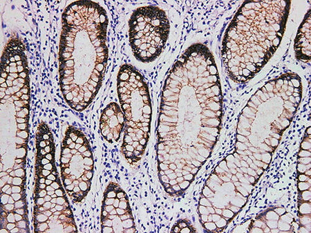 Claudin 3 Monoclonal Antibody Stored at -20°C