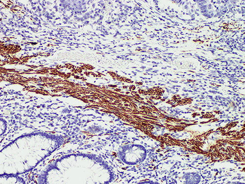 Desmin Monoclonal Antibody Stored at -20°C