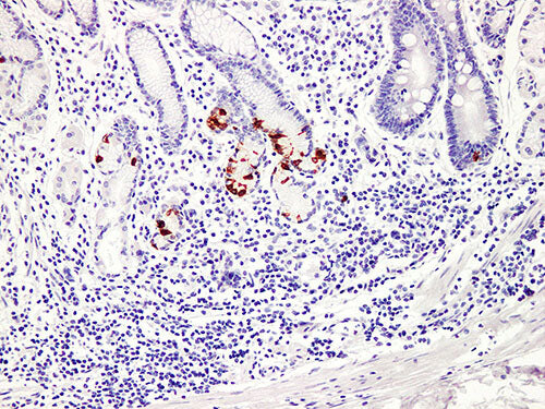 Gastrin Monoclonal Antibody Stored at -20°C