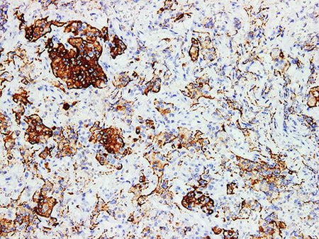 GH Monoclonal Antibody Stored at -20°C