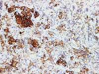 GH Monoclonal Antibody Stored at -20°C