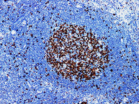 Ki-67 Monoclonal Antibody Stored at -20°C