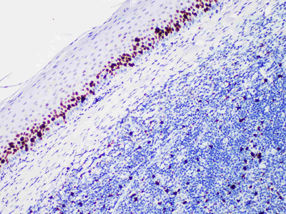 Ki-67 Monoclonal Antibody Stored at -20°C