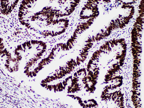 MSH6 Monoclonal Antibody Stored at -20°C Host Rabbit