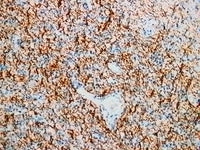 MBP Monoclonal Antibody Stored at -20°C