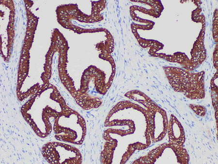 PSA Monoclonal Antibody Stored at -20°C