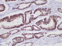 CDX-2 Monoclonal Antibody Stored at -20°C