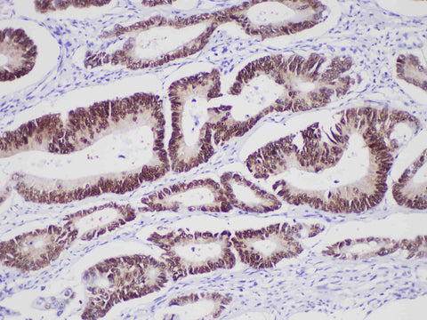CDX-2 Monoclonal Antibody Stored at -20°C