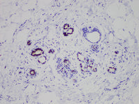 ER Monoclonal Antibody Stored at -20°C