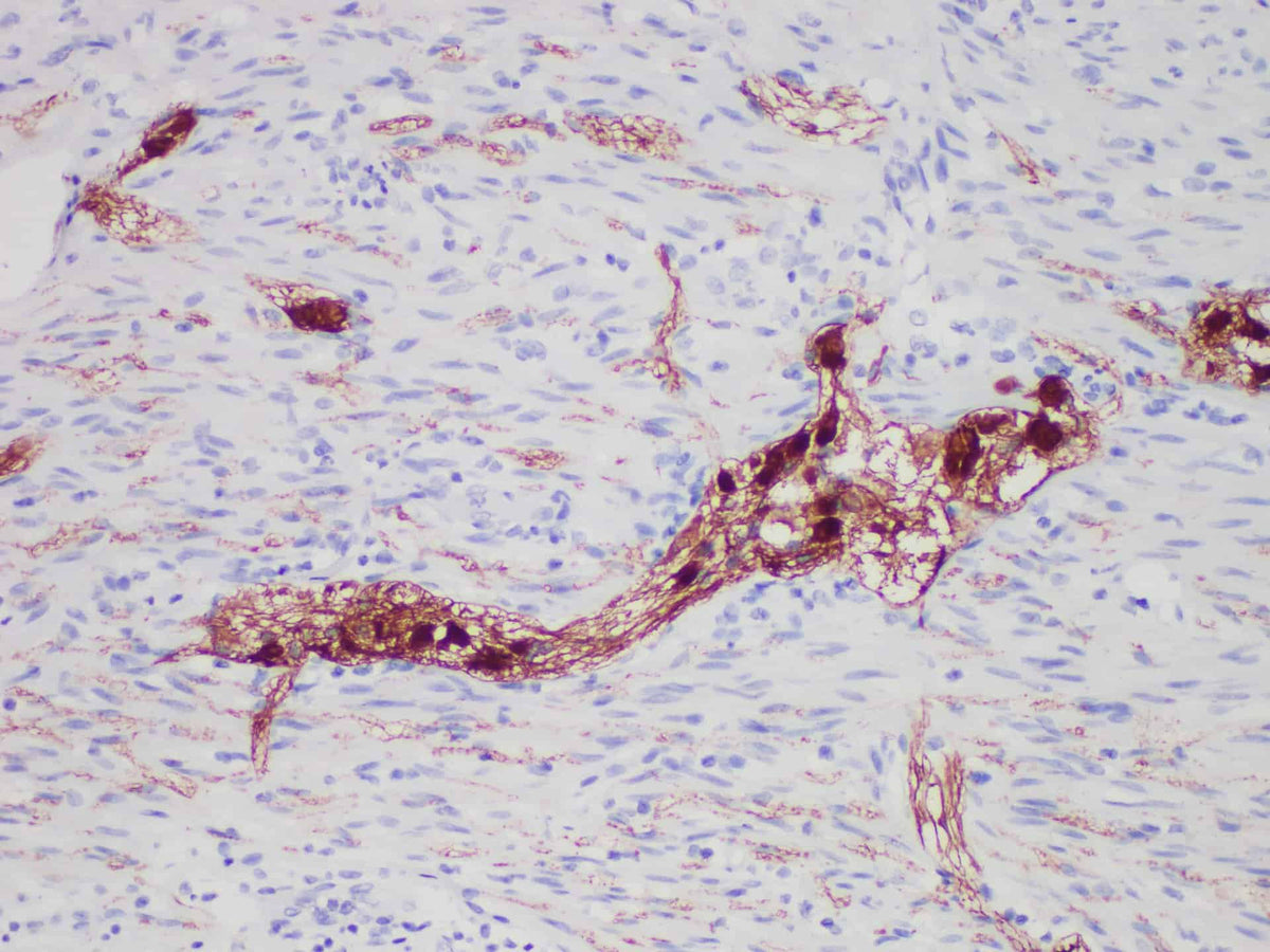 Calretinin （CR） Monoclonal Antibody
