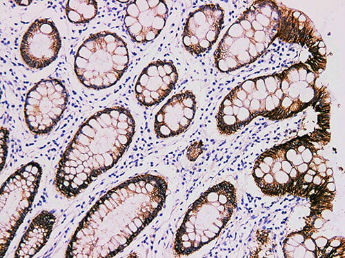 Claudin 4 Monoclonal Antibody Stored at -20°C