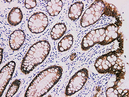 Claudin 4 Monoclonal Antibody Stored at -20°C