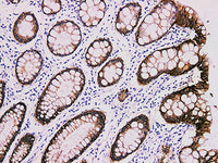 Claudin 4 Monoclonal Antibody Stored at -20°C