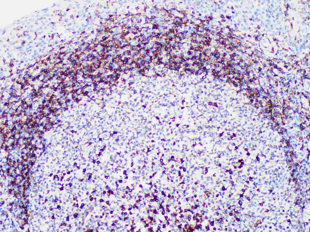 CD79a Monoclonal Antibody Stored at -20°C