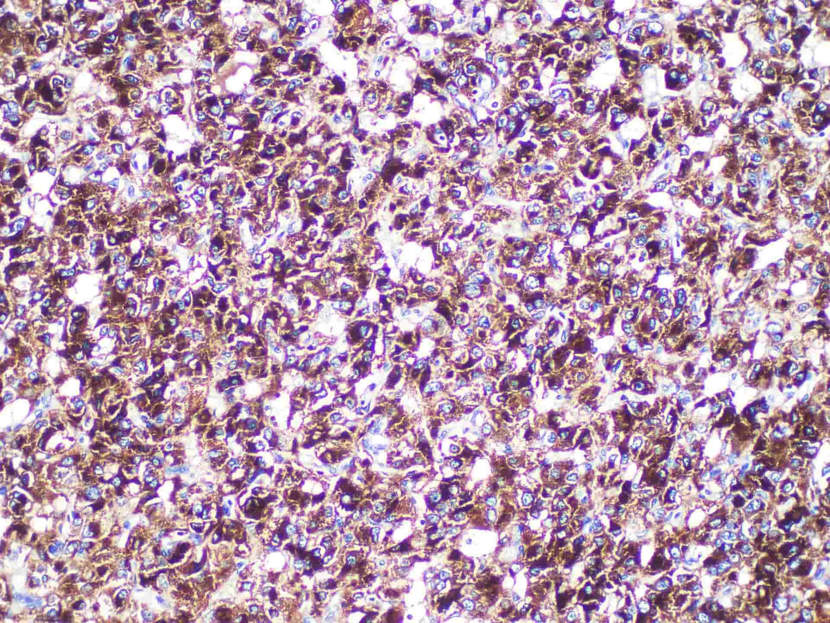 CgA Monoclonal Antibody Stored at -20°C
