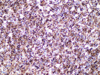 CgA Monoclonal Antibody Stored at -20°C