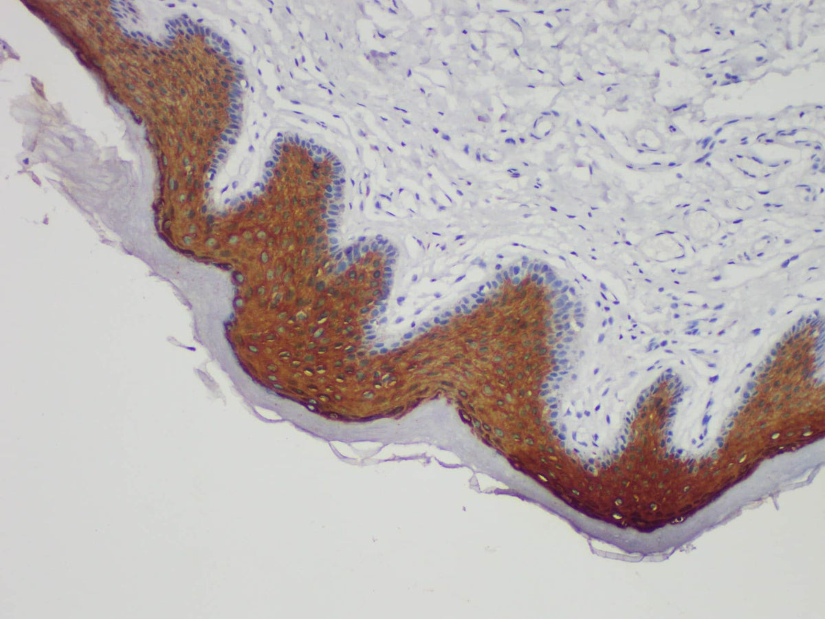 CK10 Monoclonal Antibody Stored at -20°C