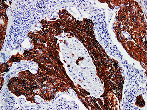 CK17 Monoclonal Antibody Stored at -20°C