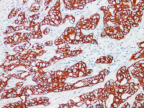 CK7 Monoclonal Antibody Stored at -20°C