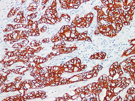 CK7 Monoclonal Antibody Stored at -20°C