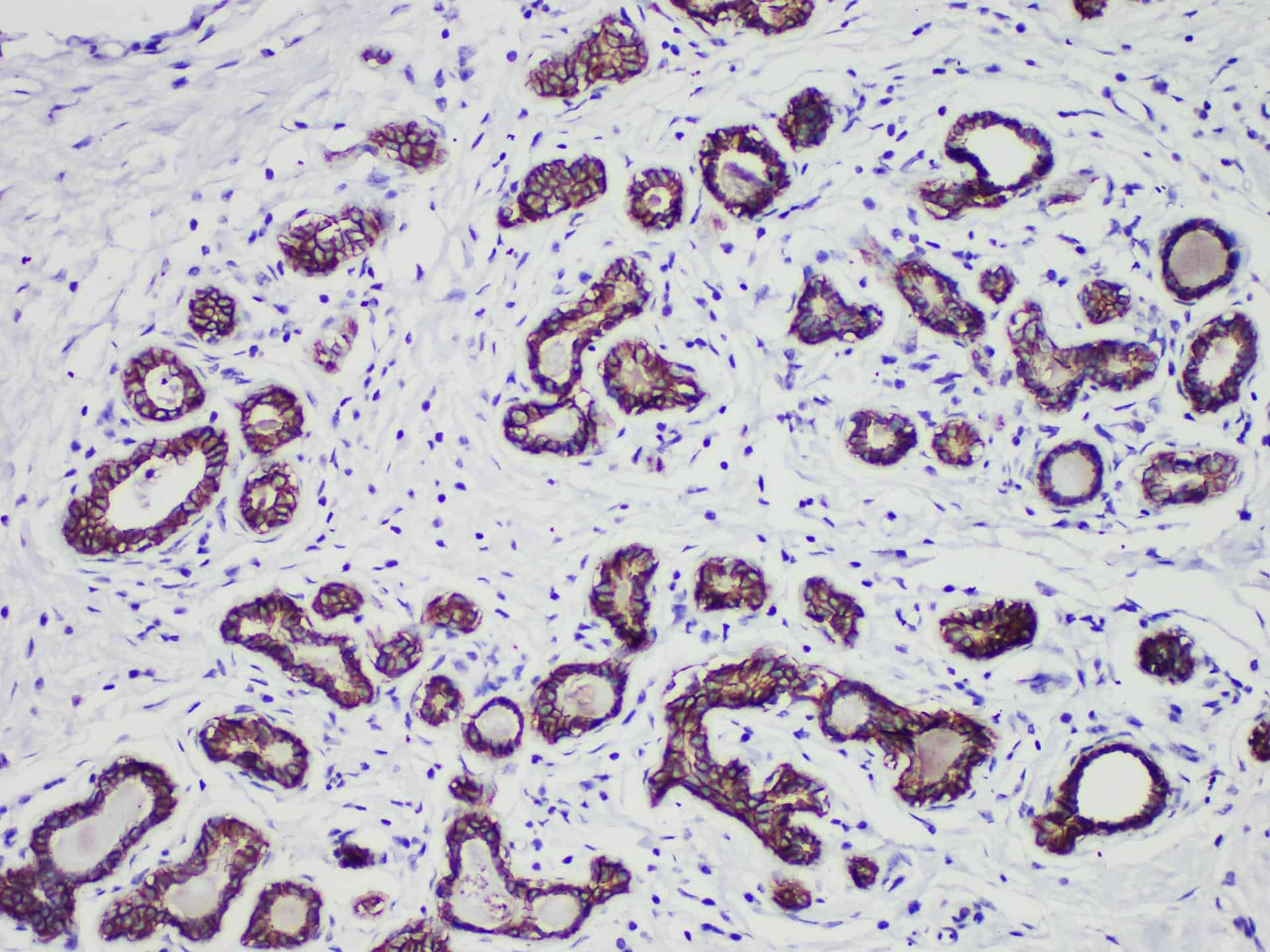 E-Cadherin Monoclonal Antibody Stored at -20°C