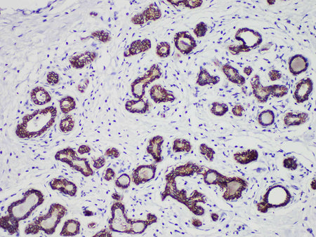 E-Cadherin Monoclonal Antibody Stored at -20°C
