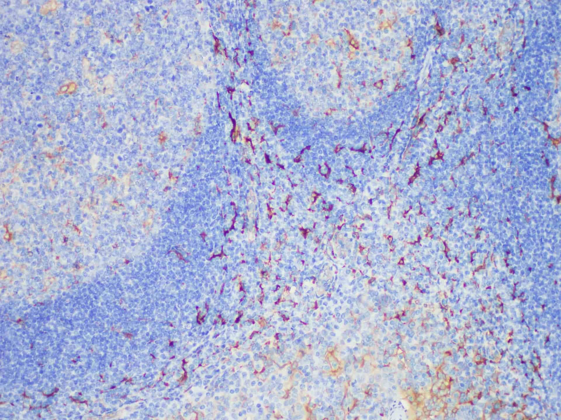Fascin Monoclonal Antibody Stored at -20°C