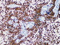 GFAP Monoclonal Antibody Stored at -20°C