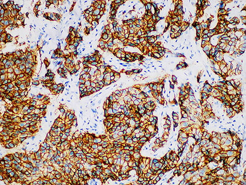 Her-2 Monoclonal Antibody Stored at -20°C
