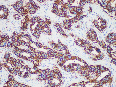 Her-2 Monoclonal Antibody Stored at -20°C Host Rabbit