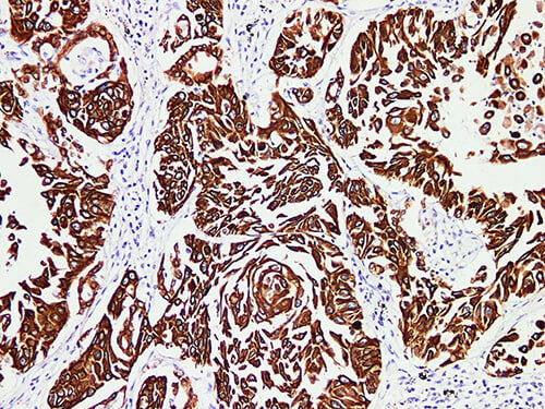 CK-Pan Monoclonal Antibody Stored at -20°C