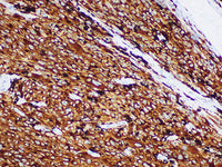 MART-1/melan A Monoclonal Antibody