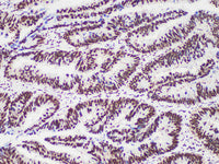 PMS2 Monoclonal Antibody Stored at -20°C