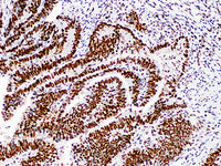 MSH2 Monoclonal Antibody Stored at -20°C