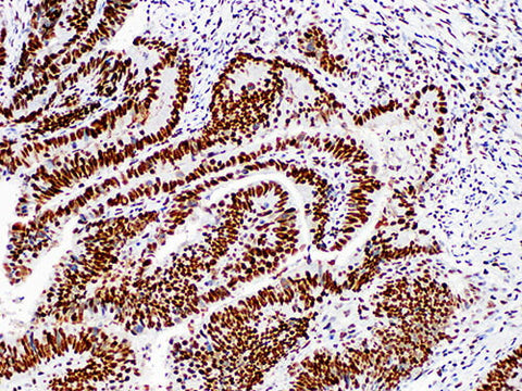 MSH2 Monoclonal Antibody Stored at -20°C