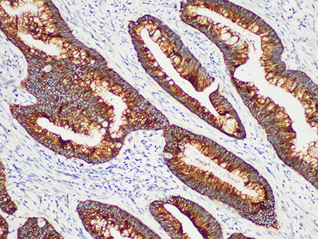 CK-LMW Monoclonal Antibody Stored at -20°C