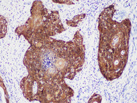 p16 Monoclonal Antibody Stored at -20°C Host Rabbit