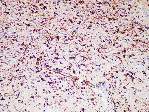 Nestin Monoclonal Antibody Stored at -20°C