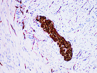 CD56 Monoclonal Antibody Stored at -20°C