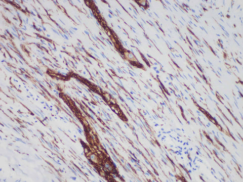 CD56 Monoclonal Antibody Stored at -20°C Host Rabbit