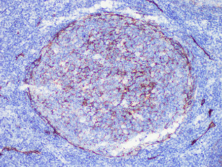 D2-40 Monoclonal Antibody Stored at -20°C