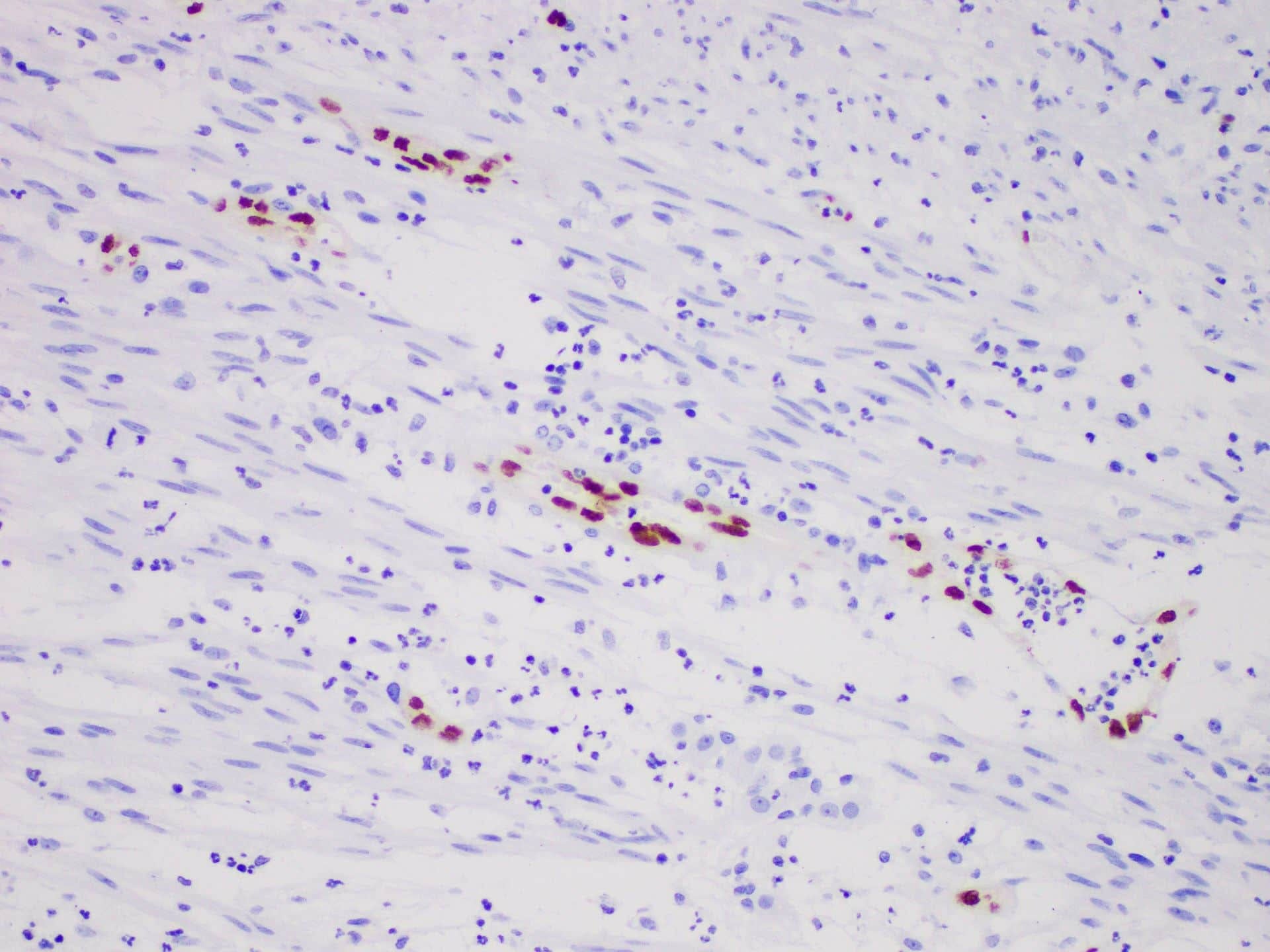 ERG Monoclonal Antibody Stored at -20°C