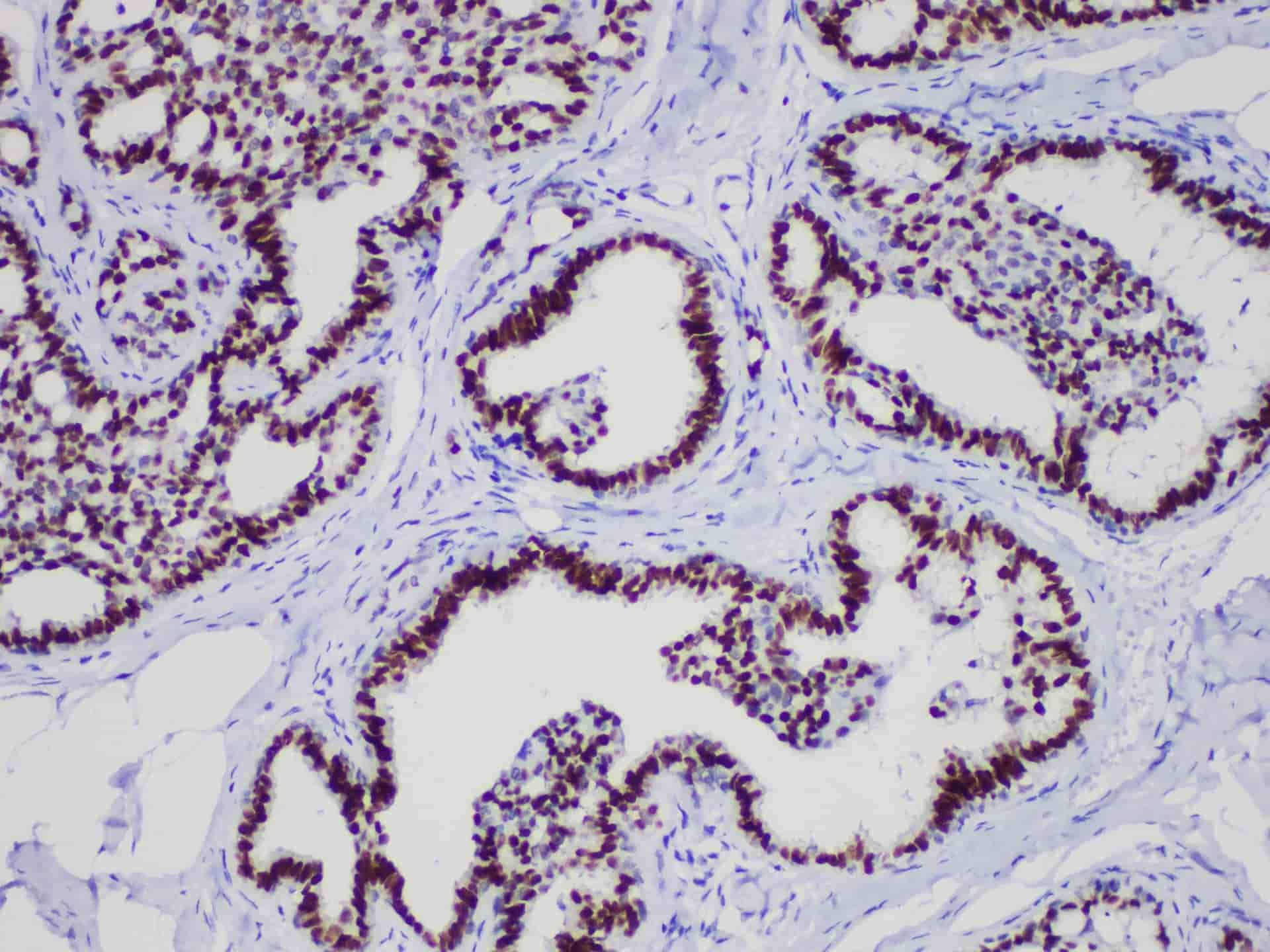 GATA3 Monoclonal Antibody Stored at -20°C